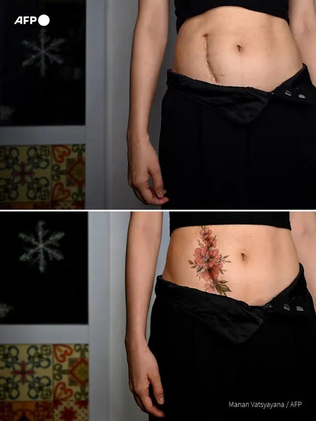 Vietnam's scar-covering witch entered the top Forbes Under 30 Asia: Famous for getting tattoos to heal wounds, was ridiculed when she first started her career - Photo 2.