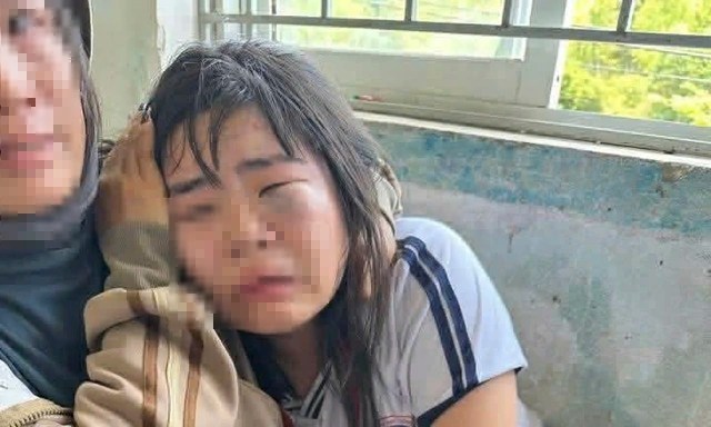 Nữ sinh lớp 7 bị nhóm nam sinh đánh hội đồng trước cổng trường- Ảnh 2.